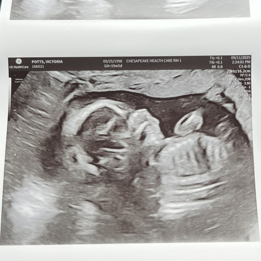 Photo shared by Victoria for their Babylist baby registry.