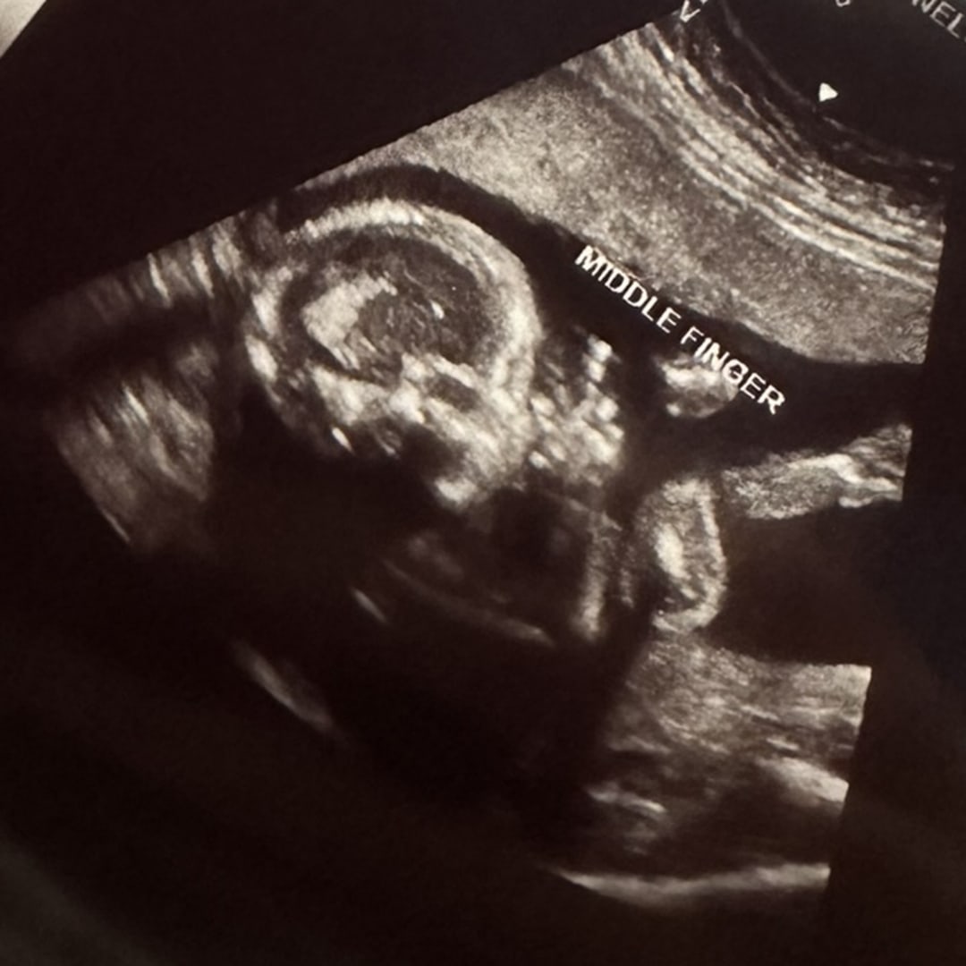 Photo shared by Hannah for their Babylist baby registry.