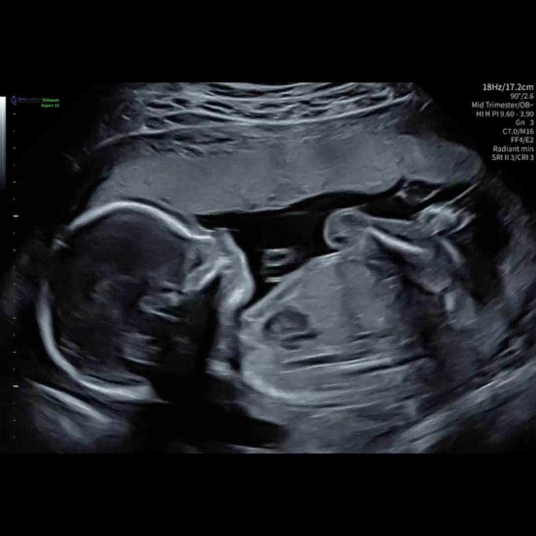 Photo shared by Claire for their Babylist baby registry.