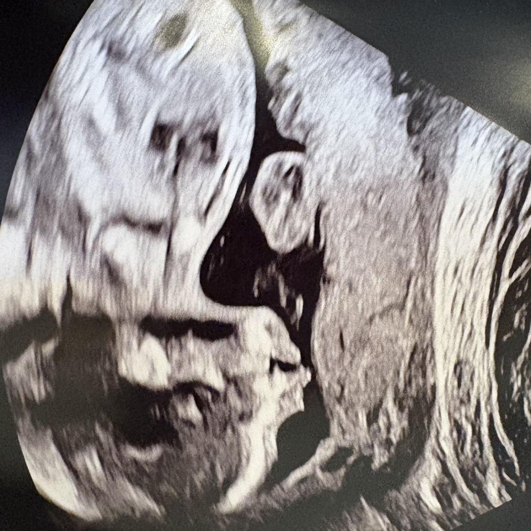Photo shared by Ryann for their Babylist baby registry.