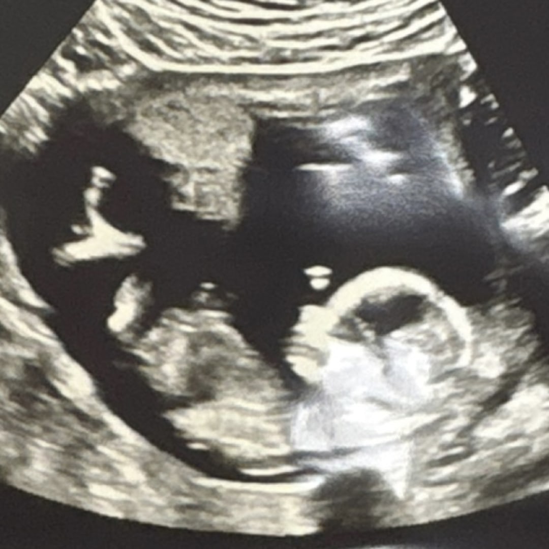 Photo shared by Autumn for their Babylist baby registry.
