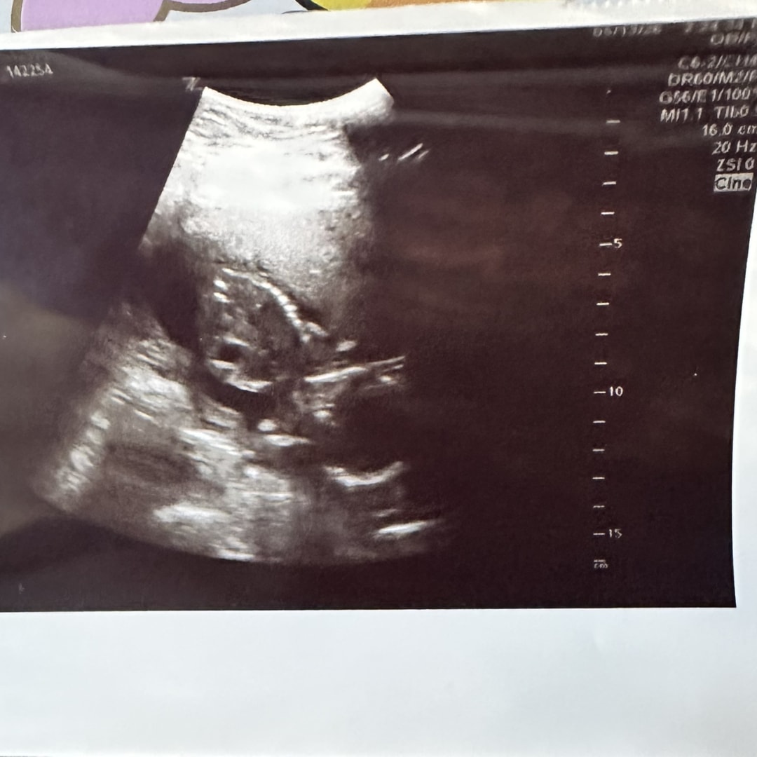 Photo shared by Carla for their Babylist baby registry.