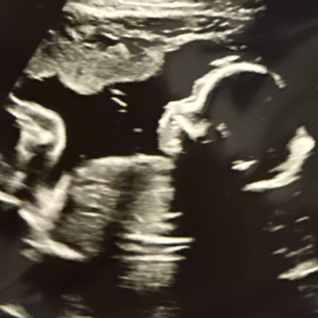 Photo shared by Gaby for their Babylist baby registry.