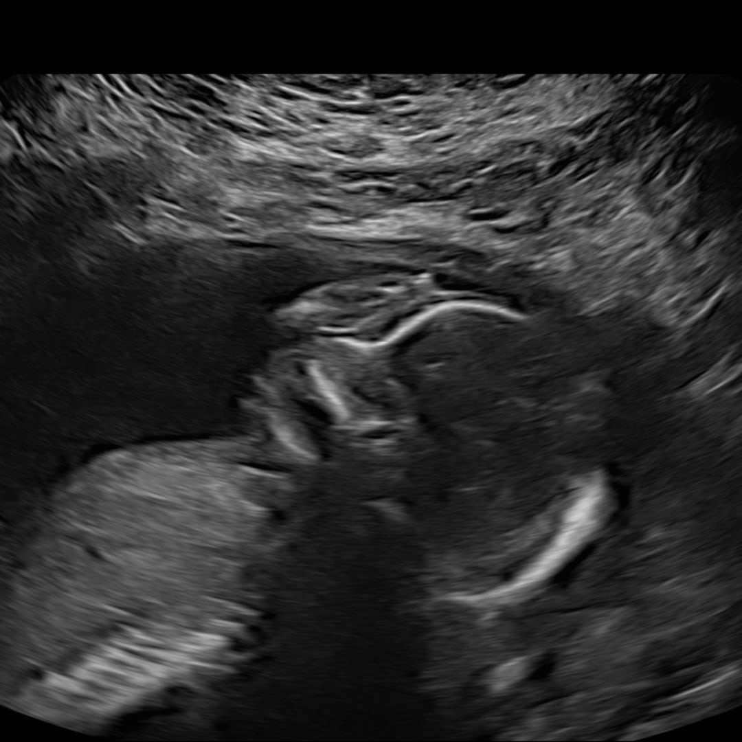 Photo shared by Rodlyn for their Babylist baby registry.