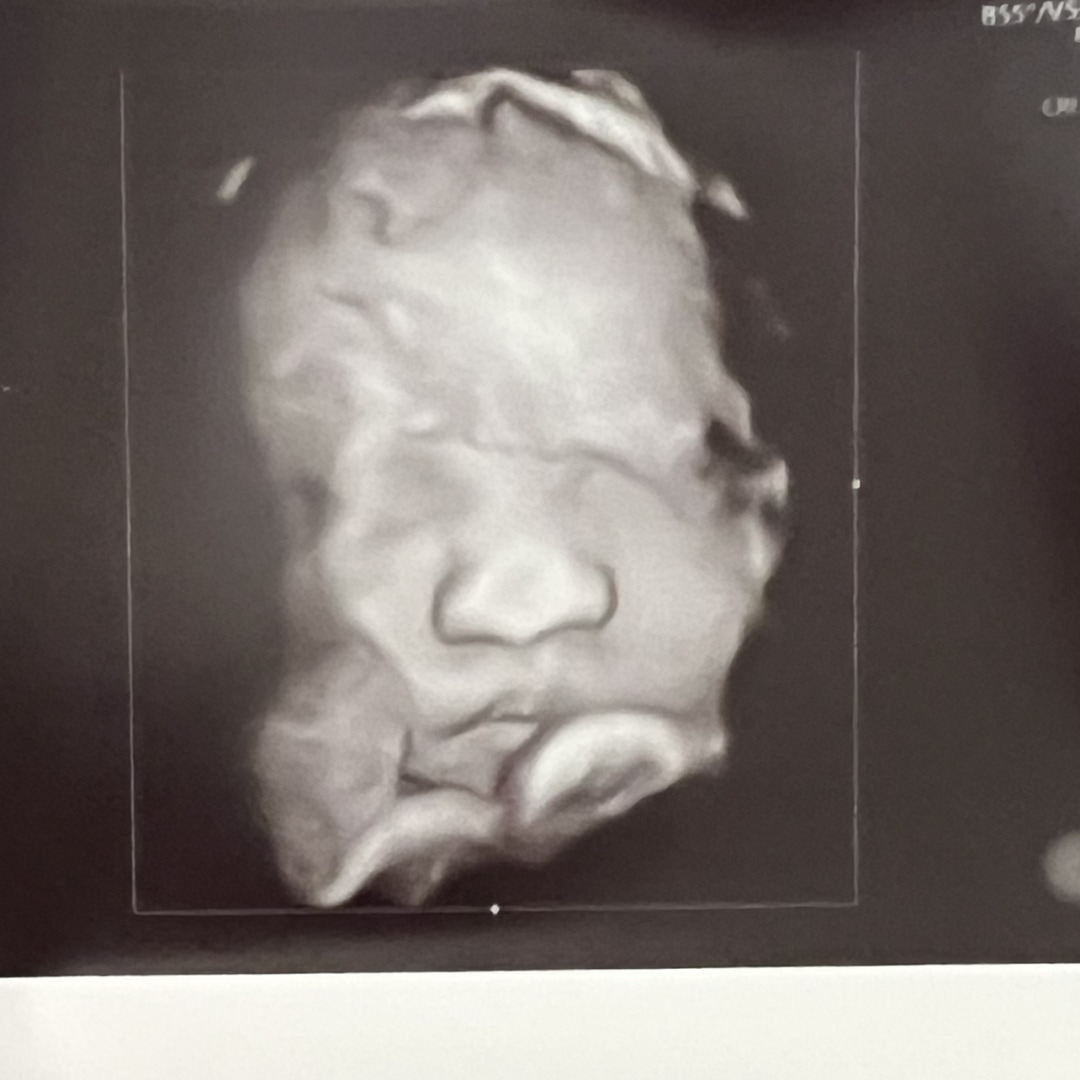 Photo shared by April for their Babylist baby registry.