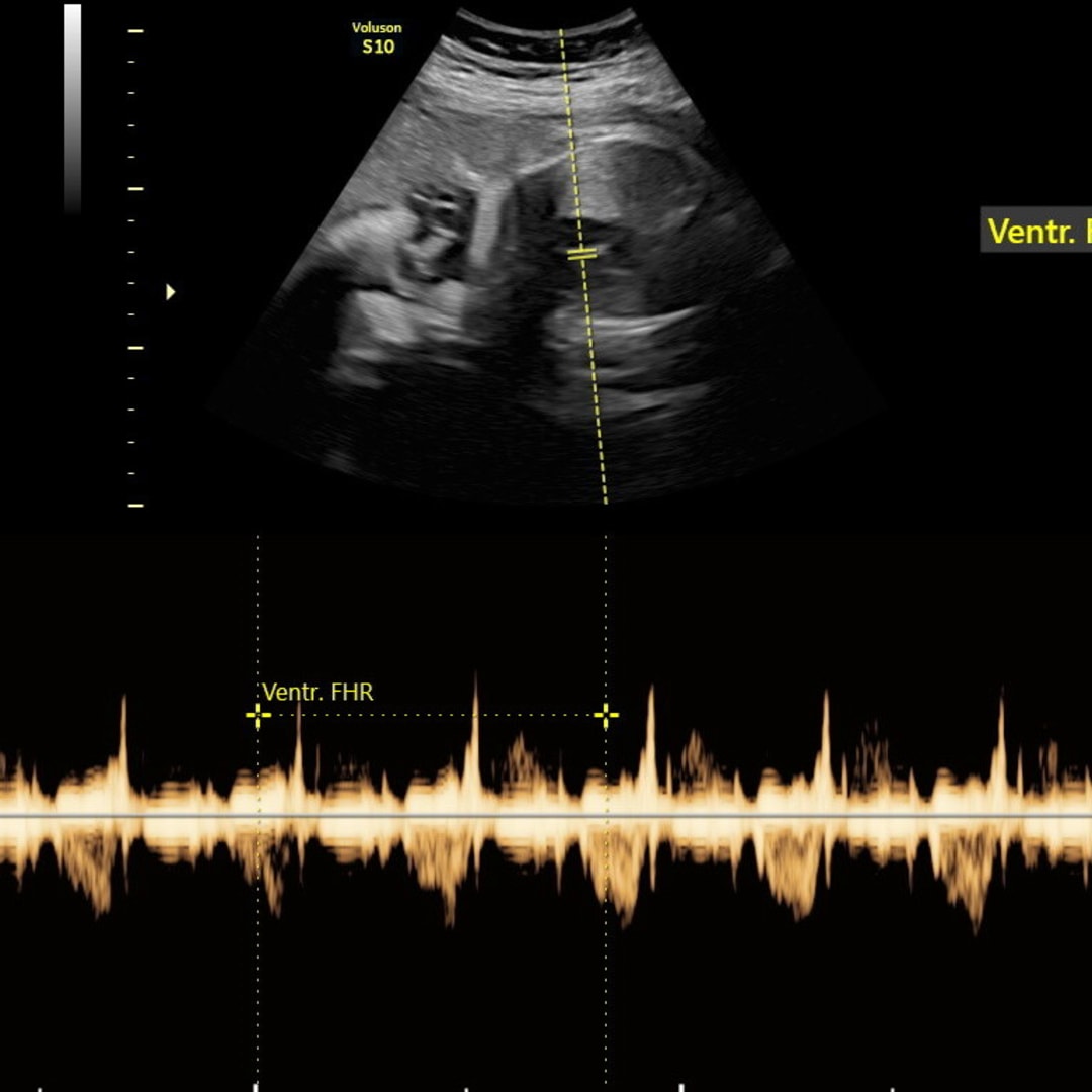 Photo shared by Cheyann for their Babylist baby registry.