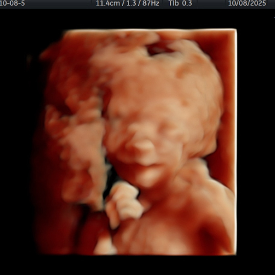 Photo shared by Evelyn for their Babylist baby registry.