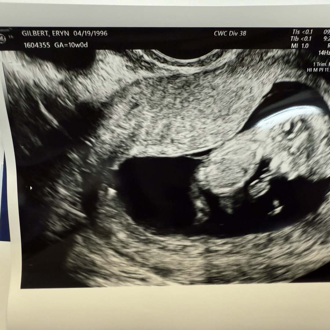 Photo shared by Eryn for their Babylist baby registry.
