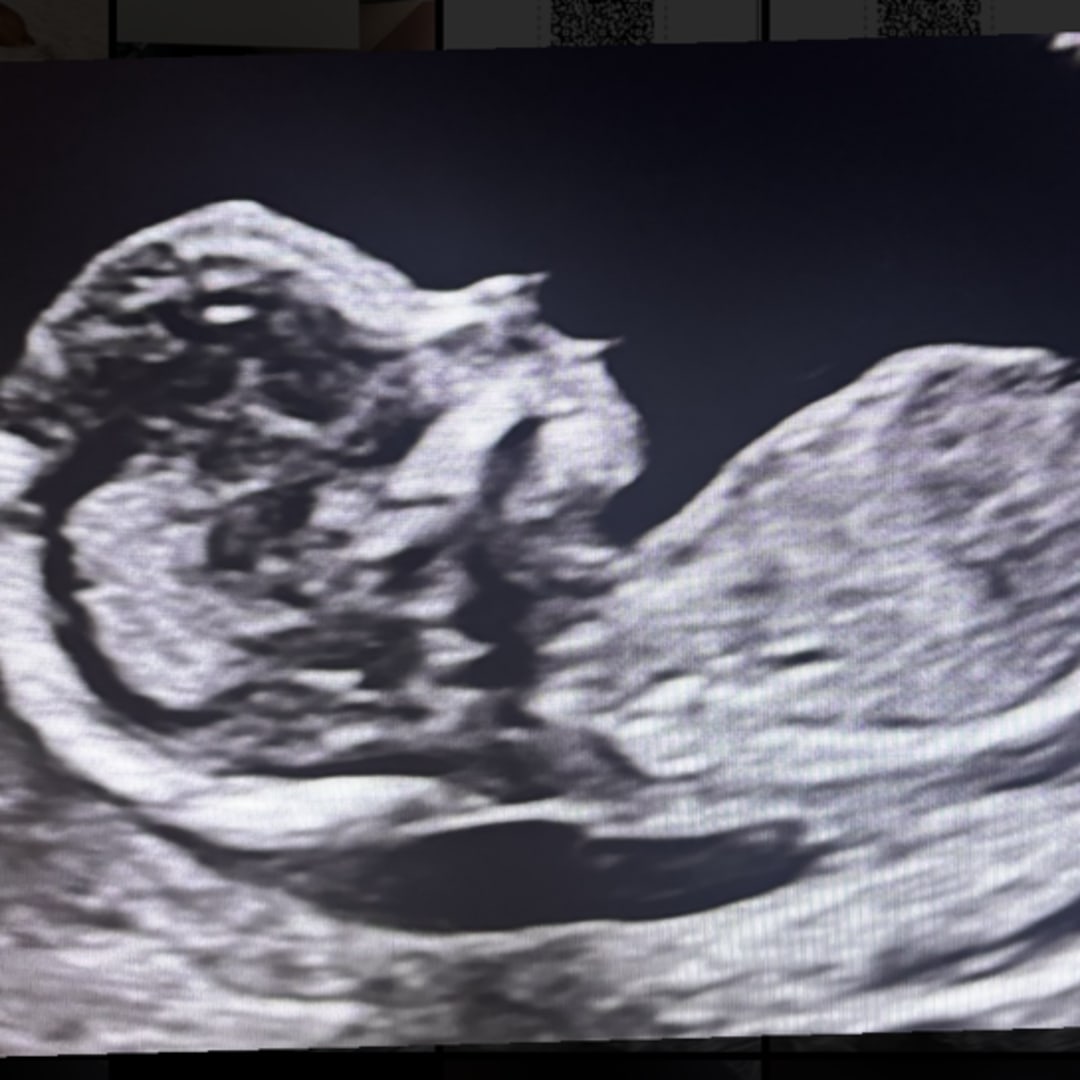 Photo shared by Kylee for their Babylist baby registry.