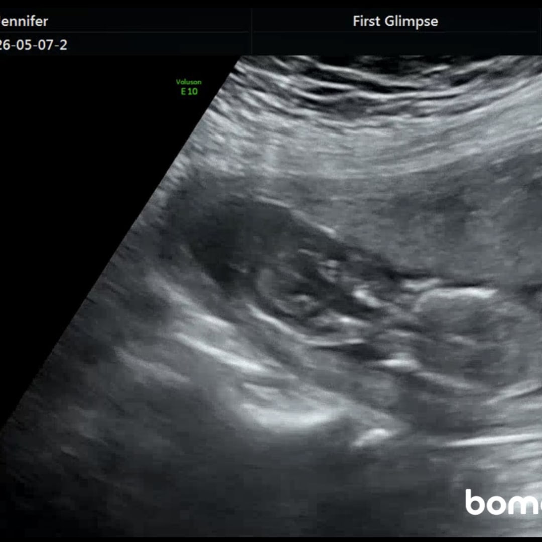 Photo shared by Jennifer for their Babylist baby registry.