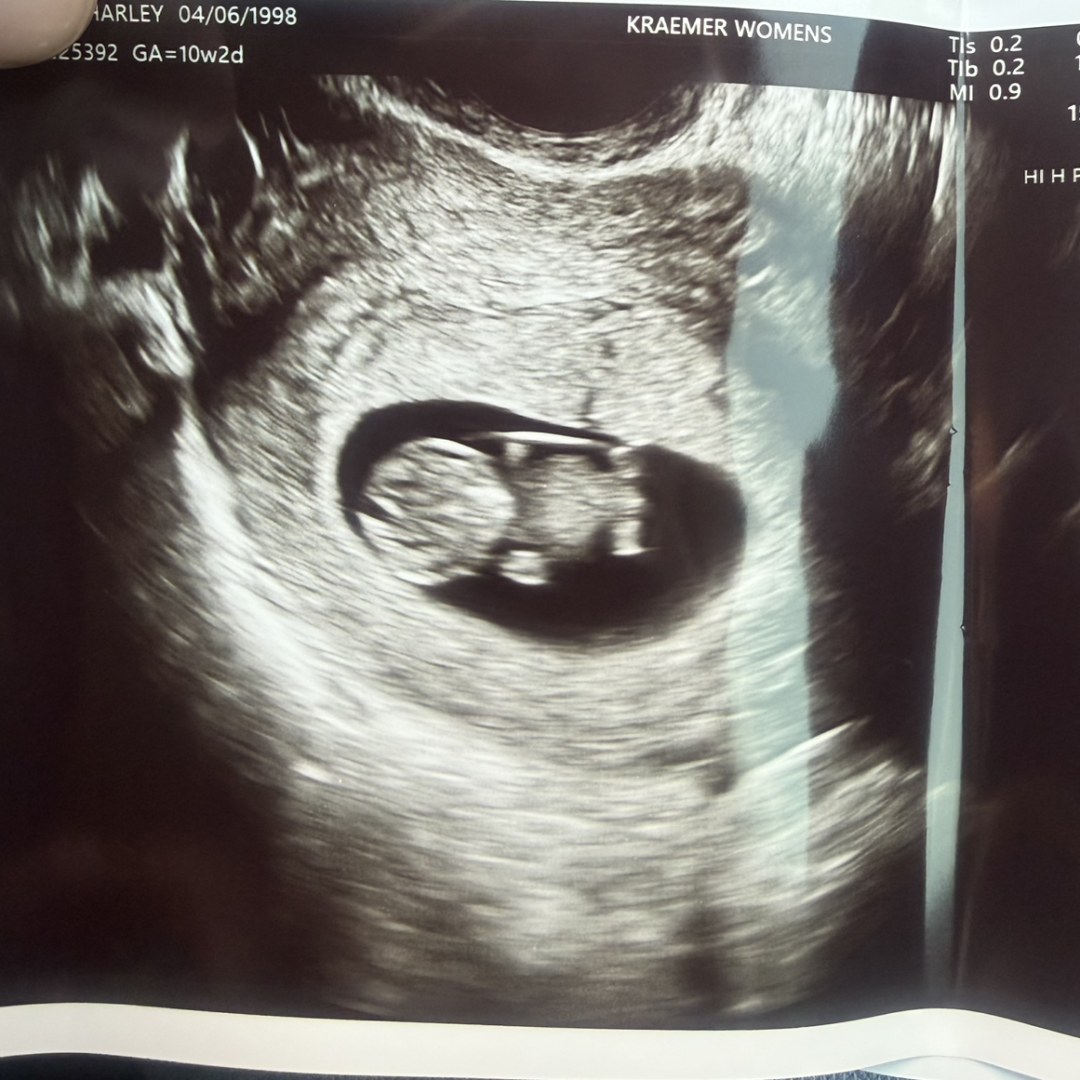 Photo shared by Harley for their Babylist baby registry.