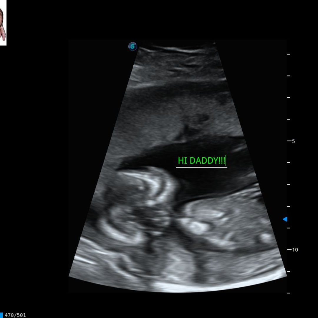 Photo shared by Marielizabeth for their Babylist baby registry.