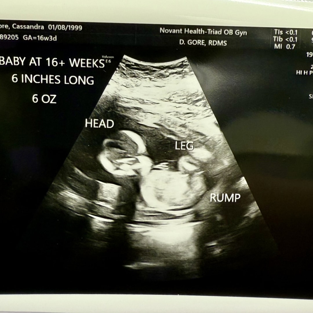 Photo shared by Cassy for their Babylist baby registry.