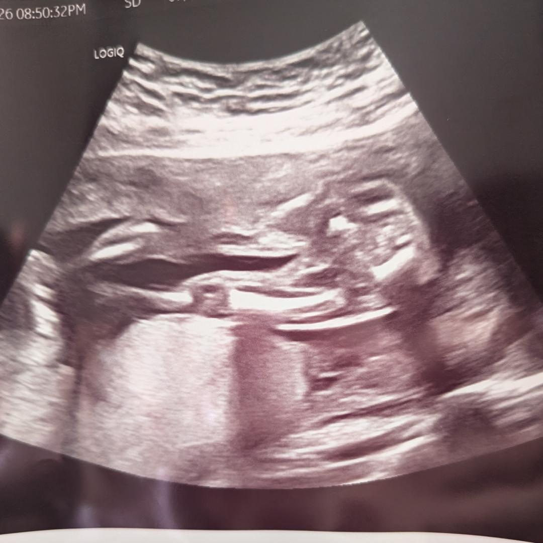 Photo shared by Geneen for their Babylist baby registry.