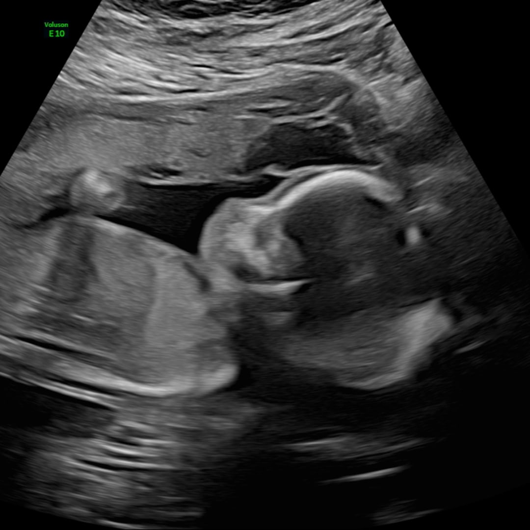 Photo shared by Adrianna for their Babylist baby registry.