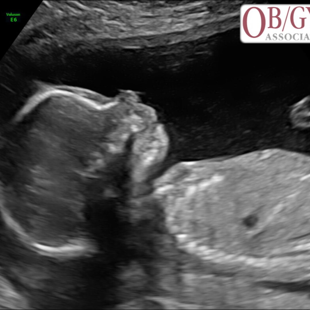 Photo shared by Emilee for their Babylist baby registry.