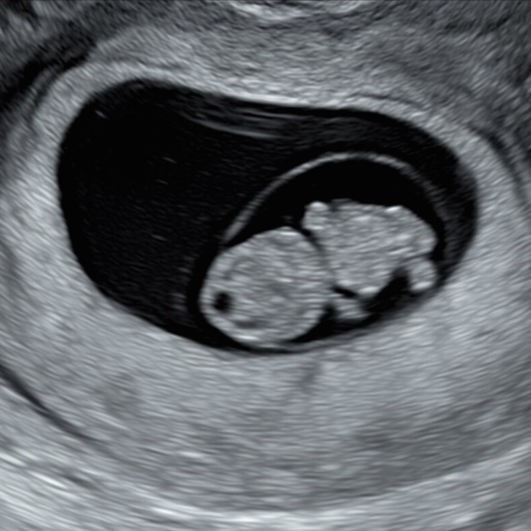 Photo shared by Marina for their Babylist baby registry.