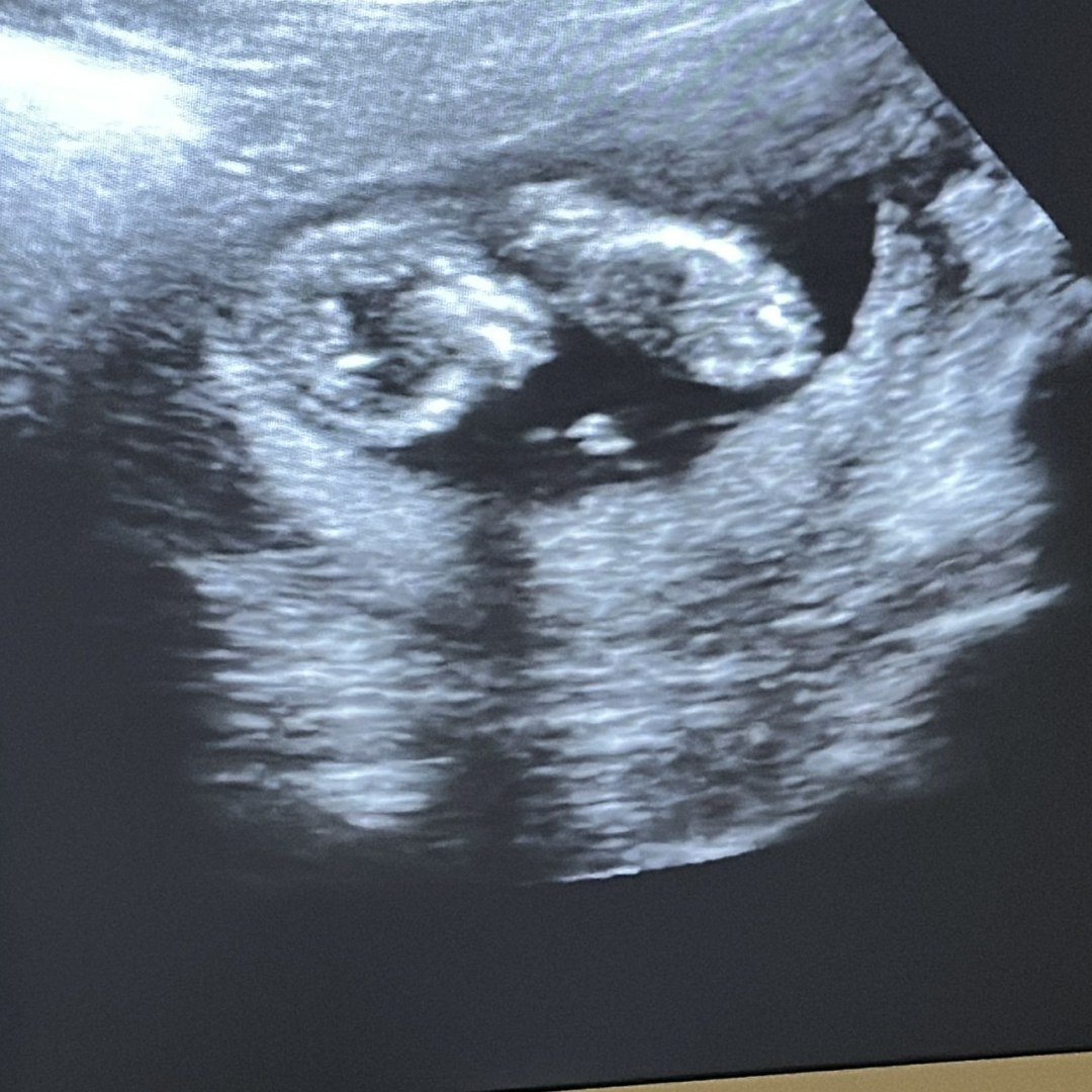 Photo shared by Alicia for their Babylist baby registry.