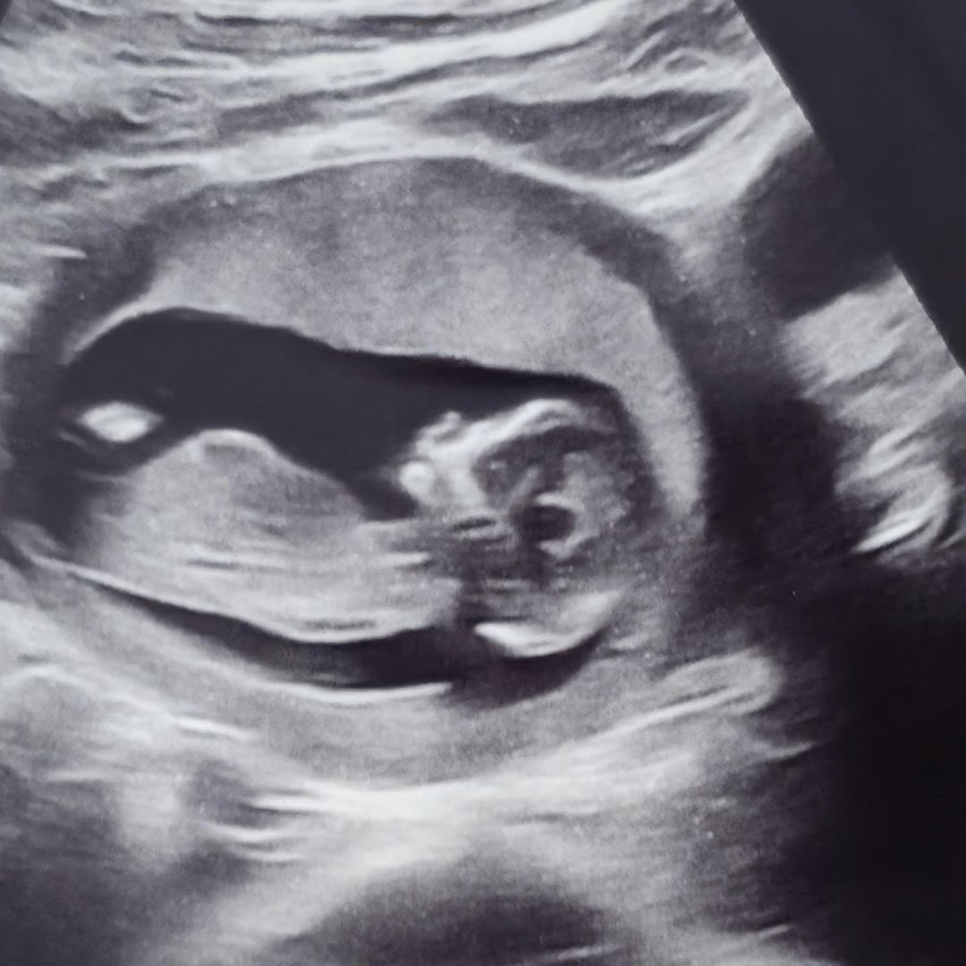 Photo shared by Brittny for their Babylist baby registry.