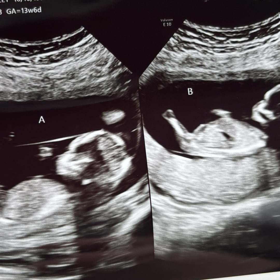 Photo shared by Haley for their Babylist baby registry.