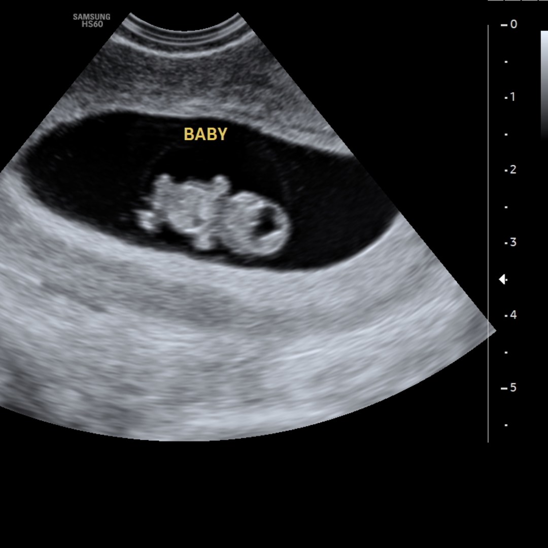 Photo shared by Katie for their Babylist baby registry.