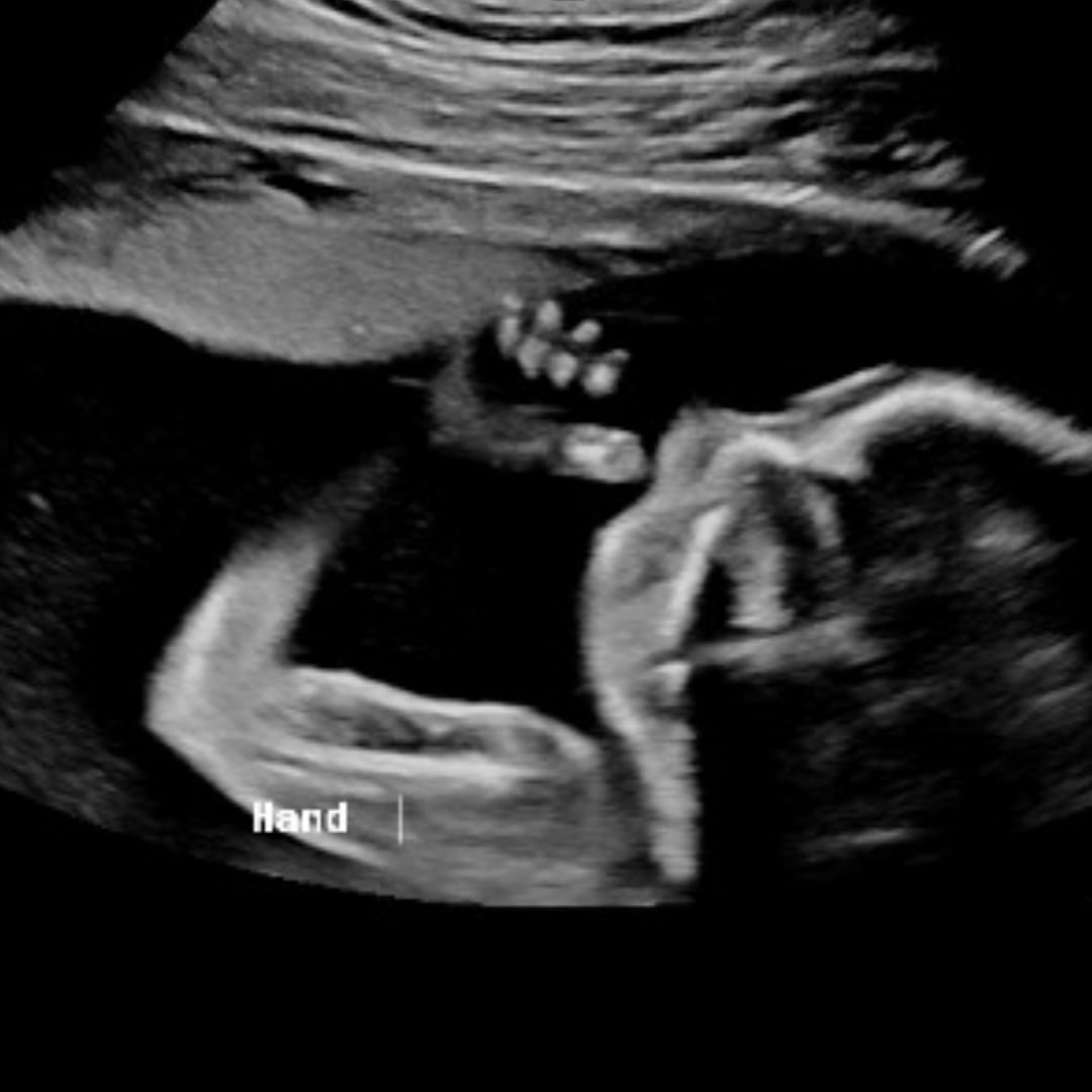 Photo shared by Olivia for their Babylist baby registry.