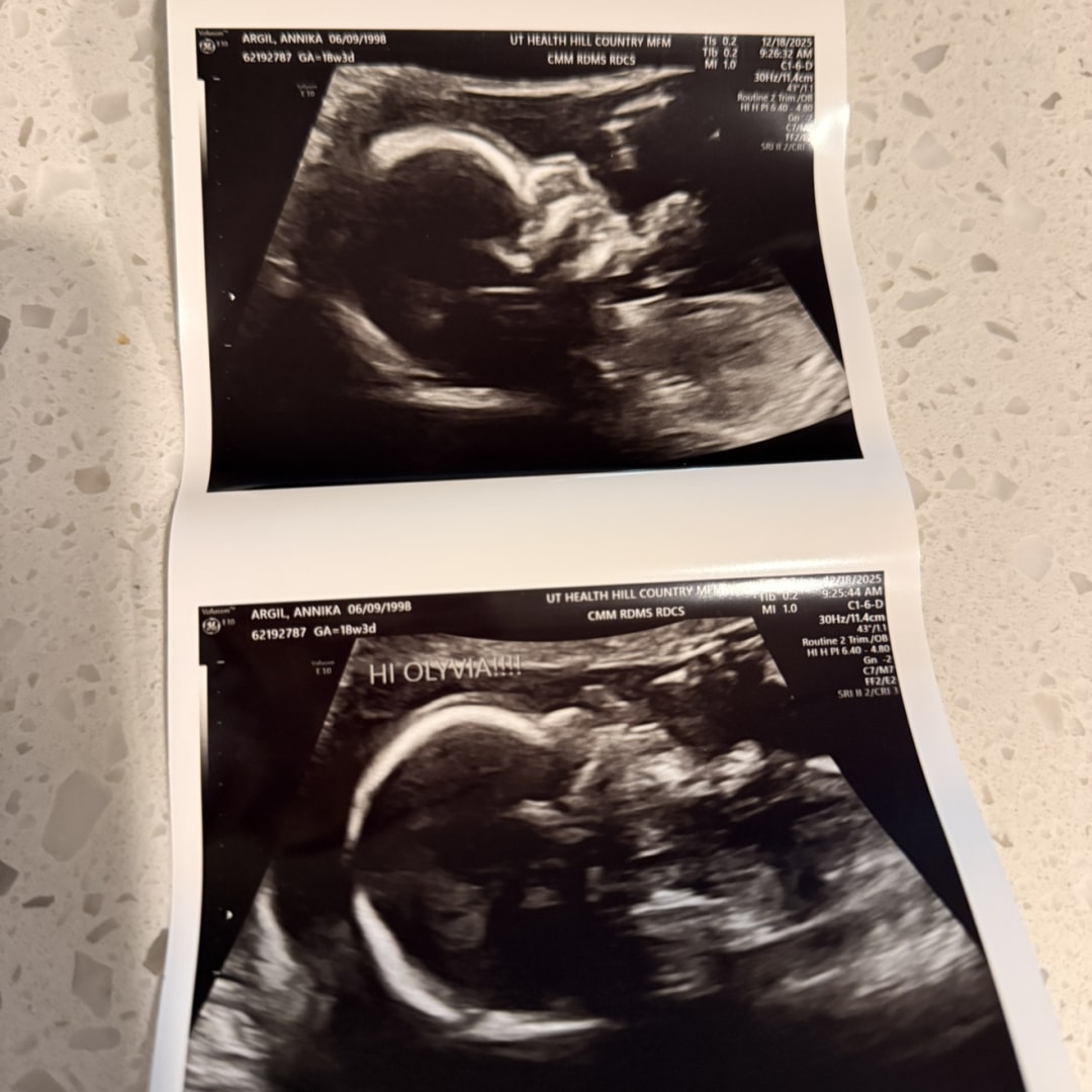 Photo shared by Annika for their Babylist baby registry.