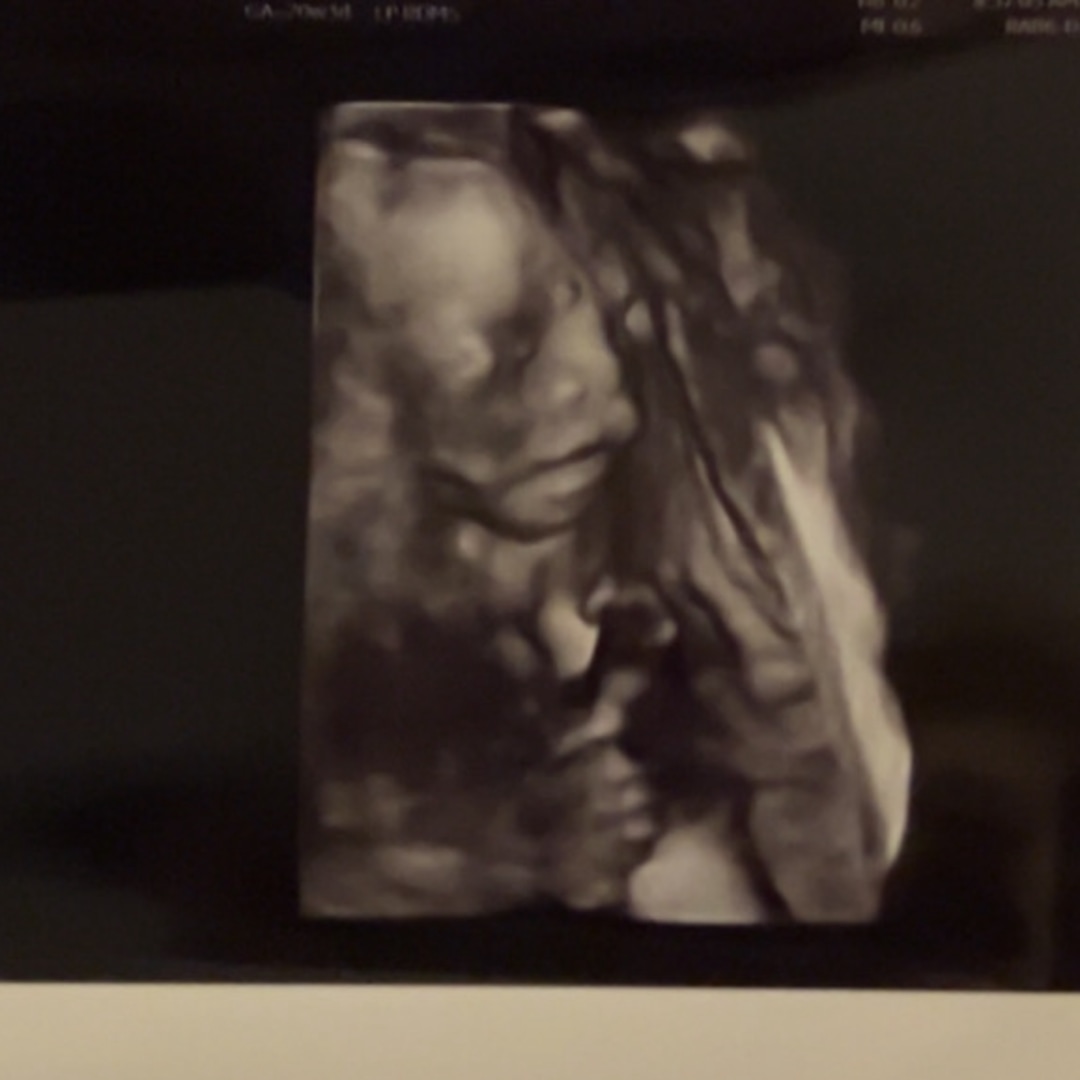 Photo shared by Lilly for their Babylist baby registry.