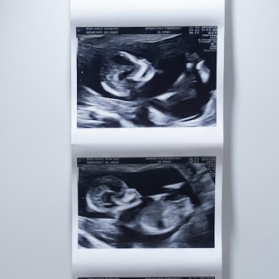 Photo shared by Kealie for their Babylist baby registry.