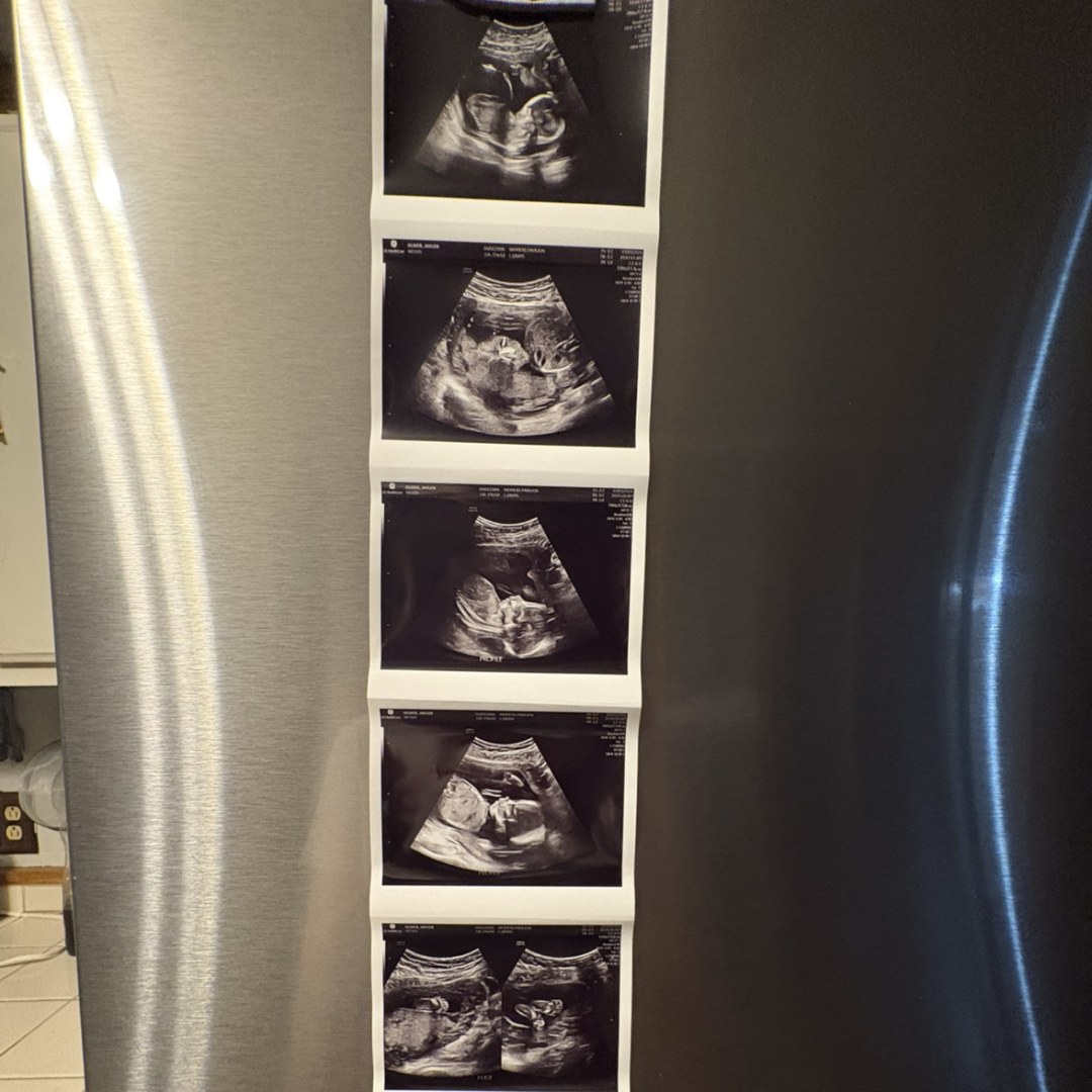 Photo shared by Jaylen for their Babylist baby registry.