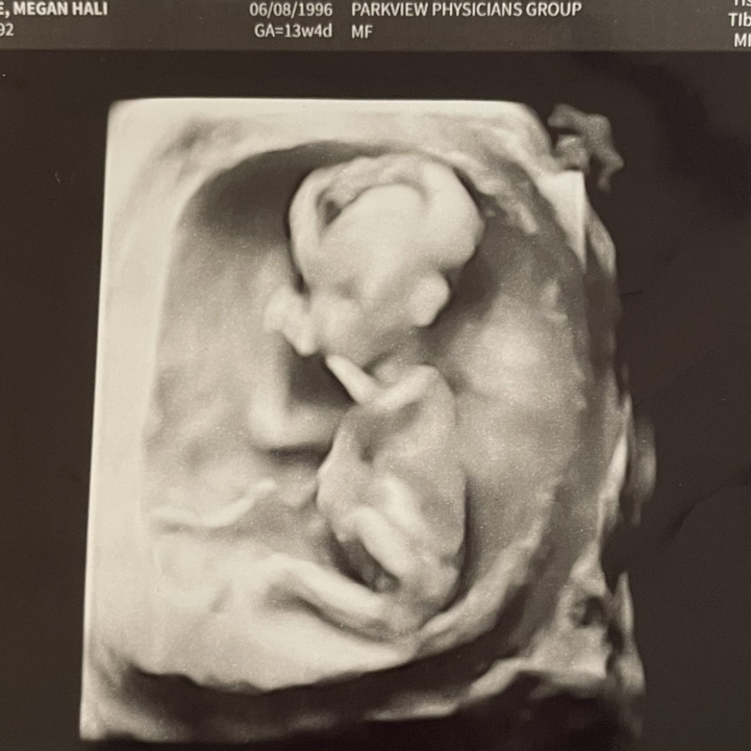 Photo shared by Megan for their Babylist baby registry.