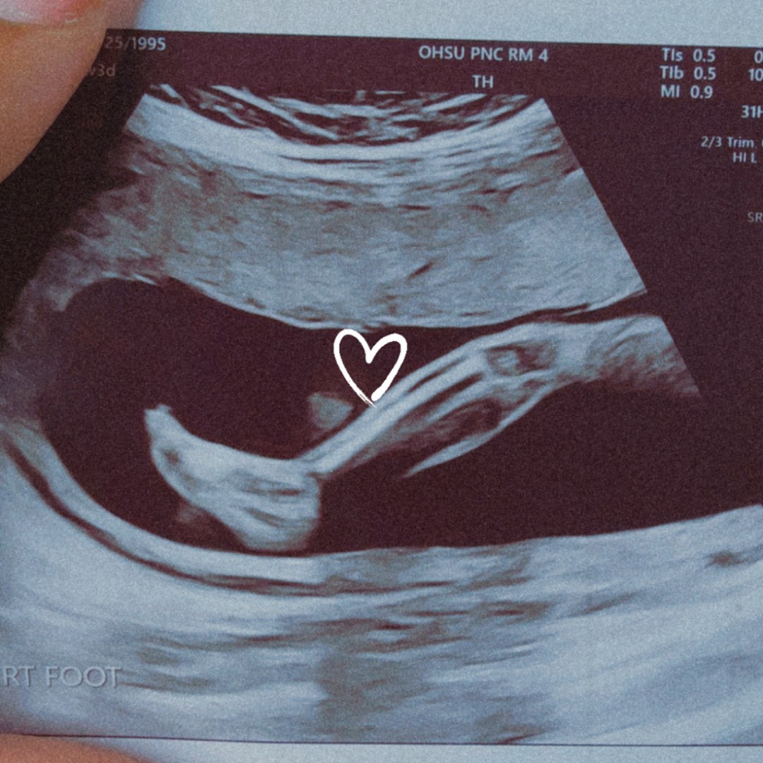 Photo shared by Kimarie for their Babylist baby registry.