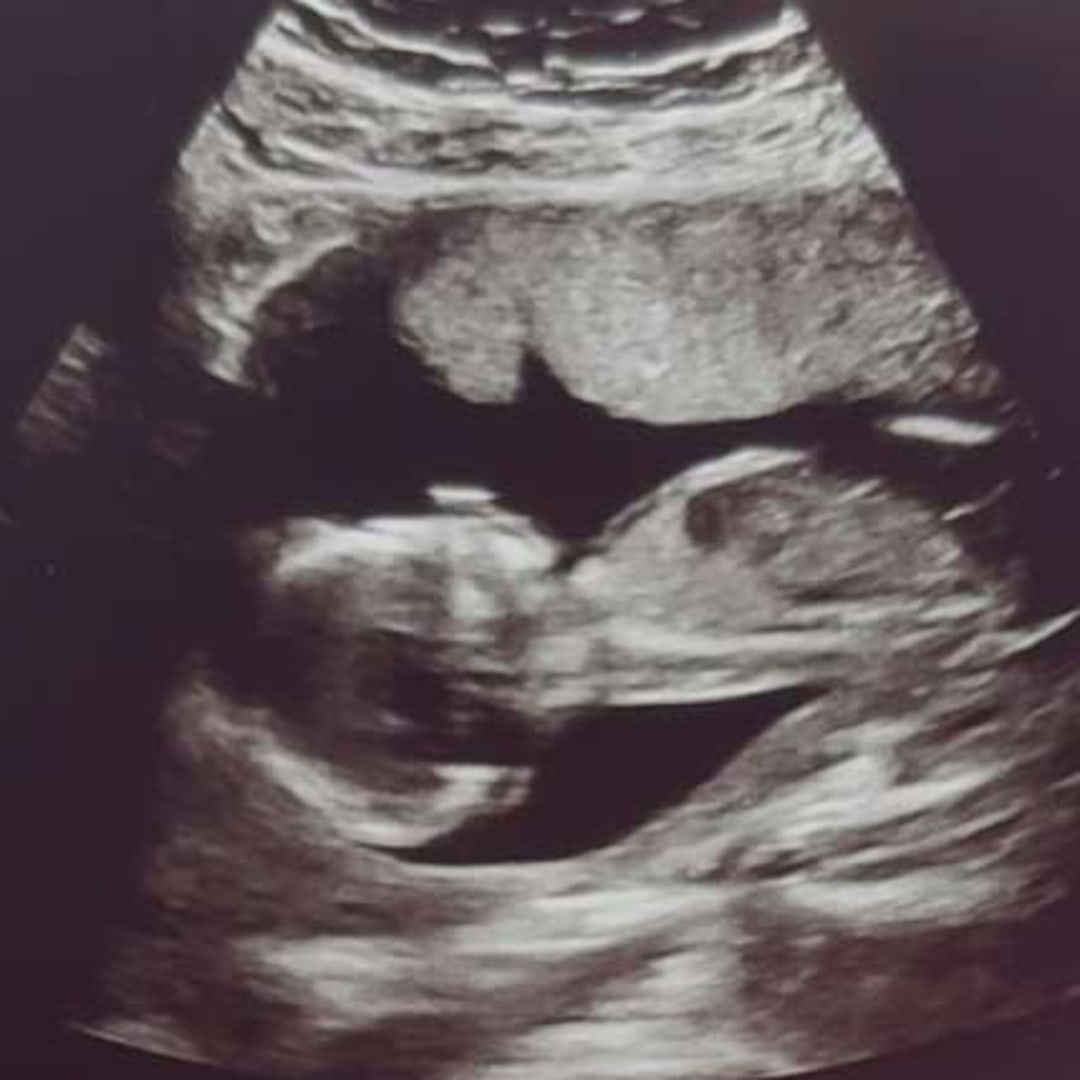 Photo shared by Ivey for their Babylist baby registry.