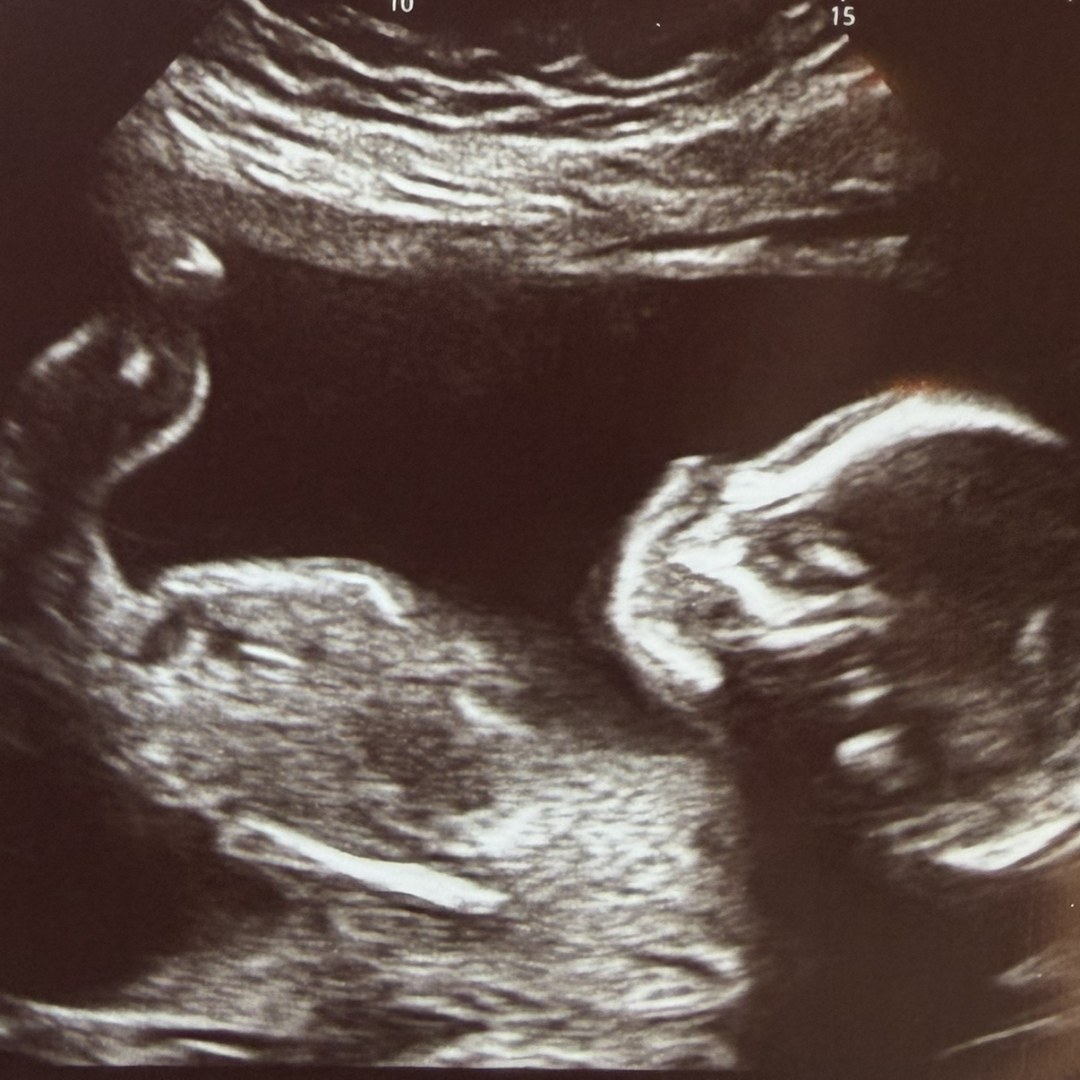 Photo shared by Morgan for their Babylist baby registry.