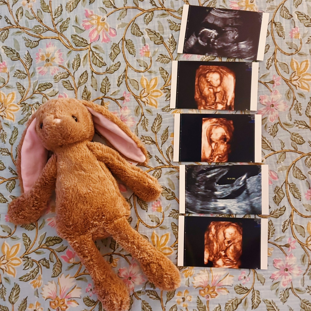 Photo shared by Eden for their Babylist baby registry.