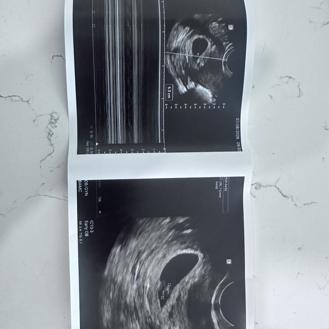 Photo shared by Elizabeth for their Babylist baby registry.