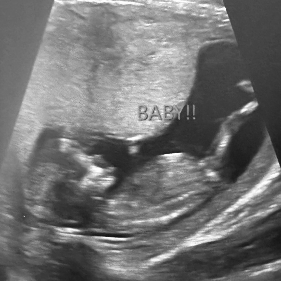 Photo shared by Kendra for their Babylist baby registry.