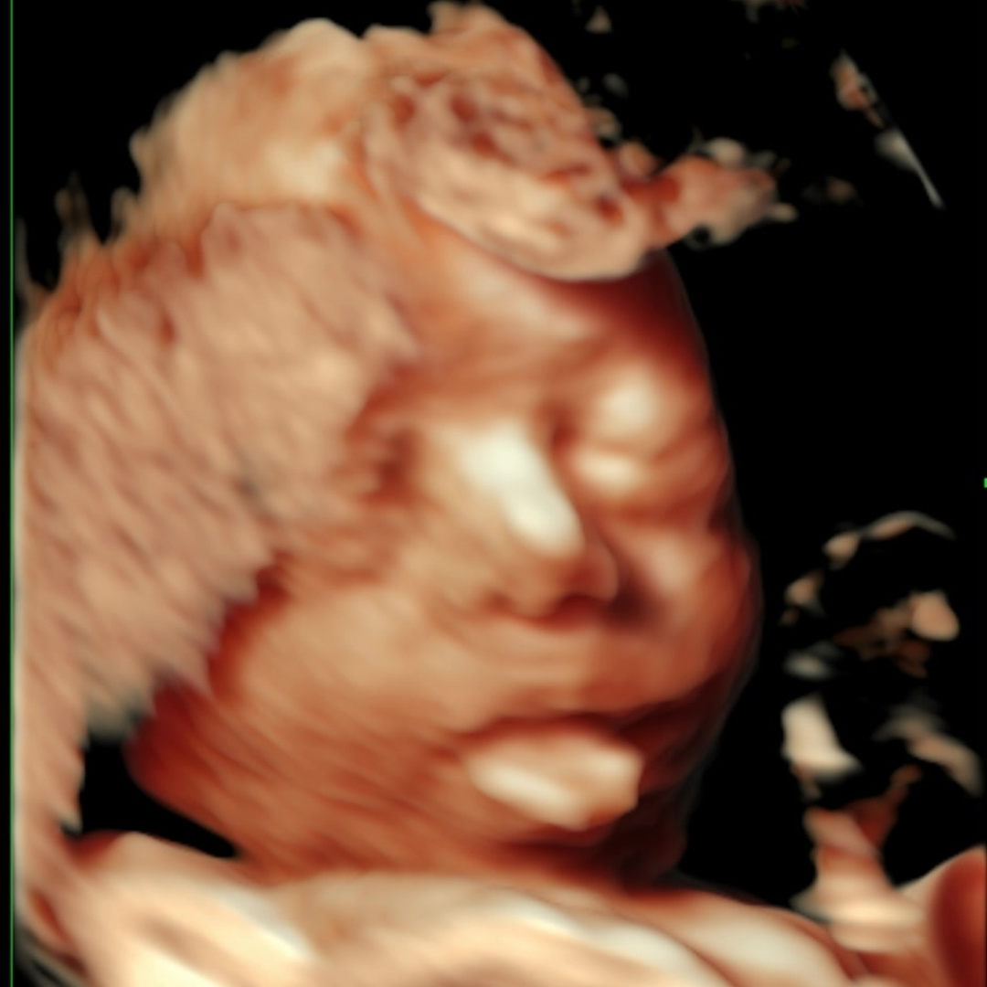 Photo shared by Charmaine Michelle for their Babylist baby registry.