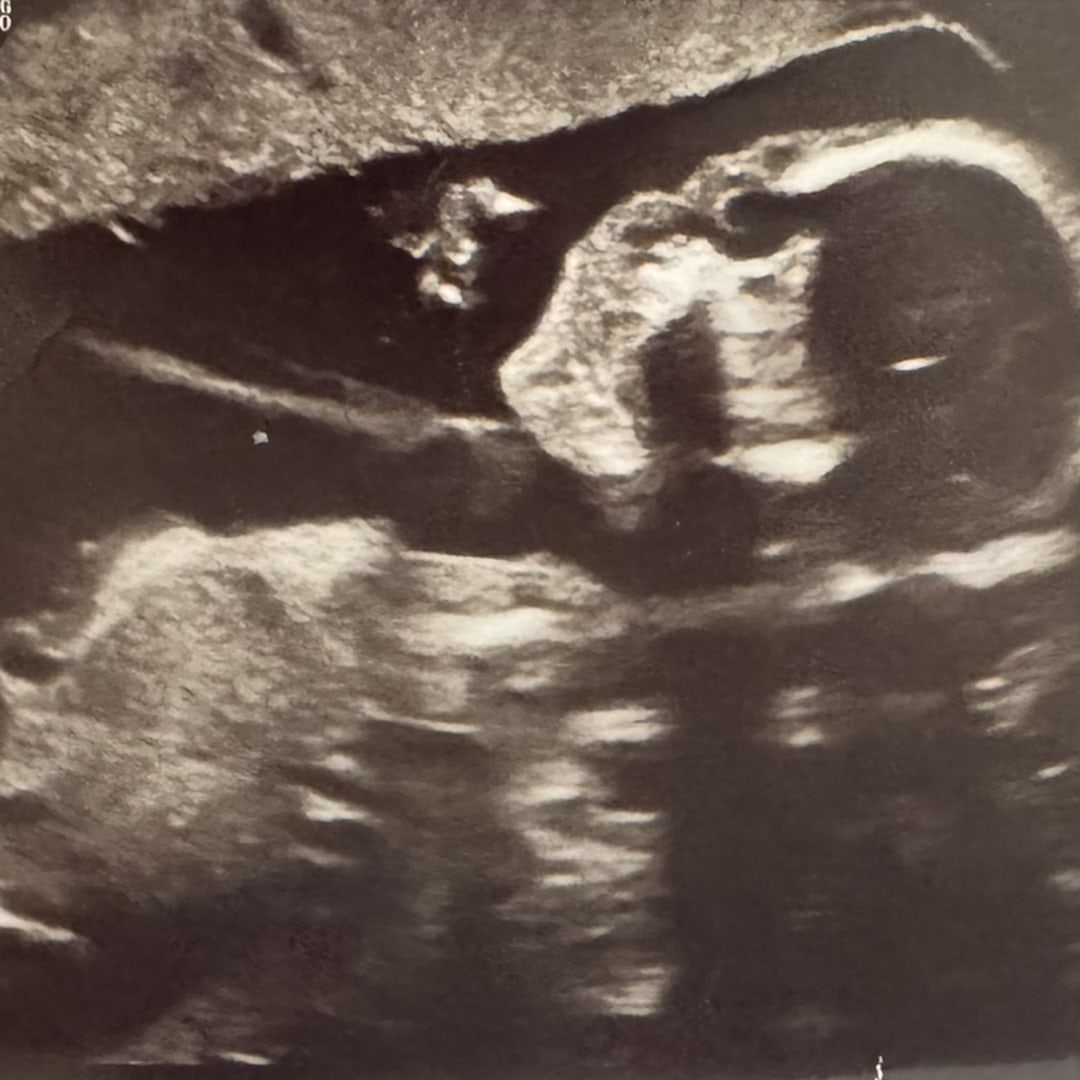 Photo shared by Caroline for their Babylist baby registry.