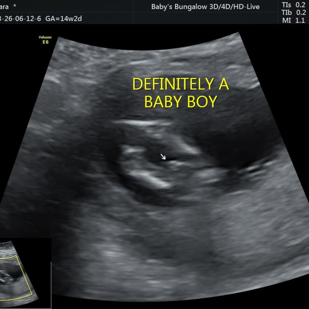 Photo shared by Sara for their Babylist baby registry.