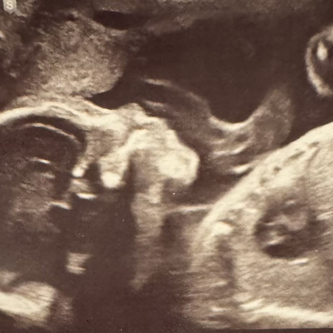 Photo shared by Alexis for their Babylist baby registry.