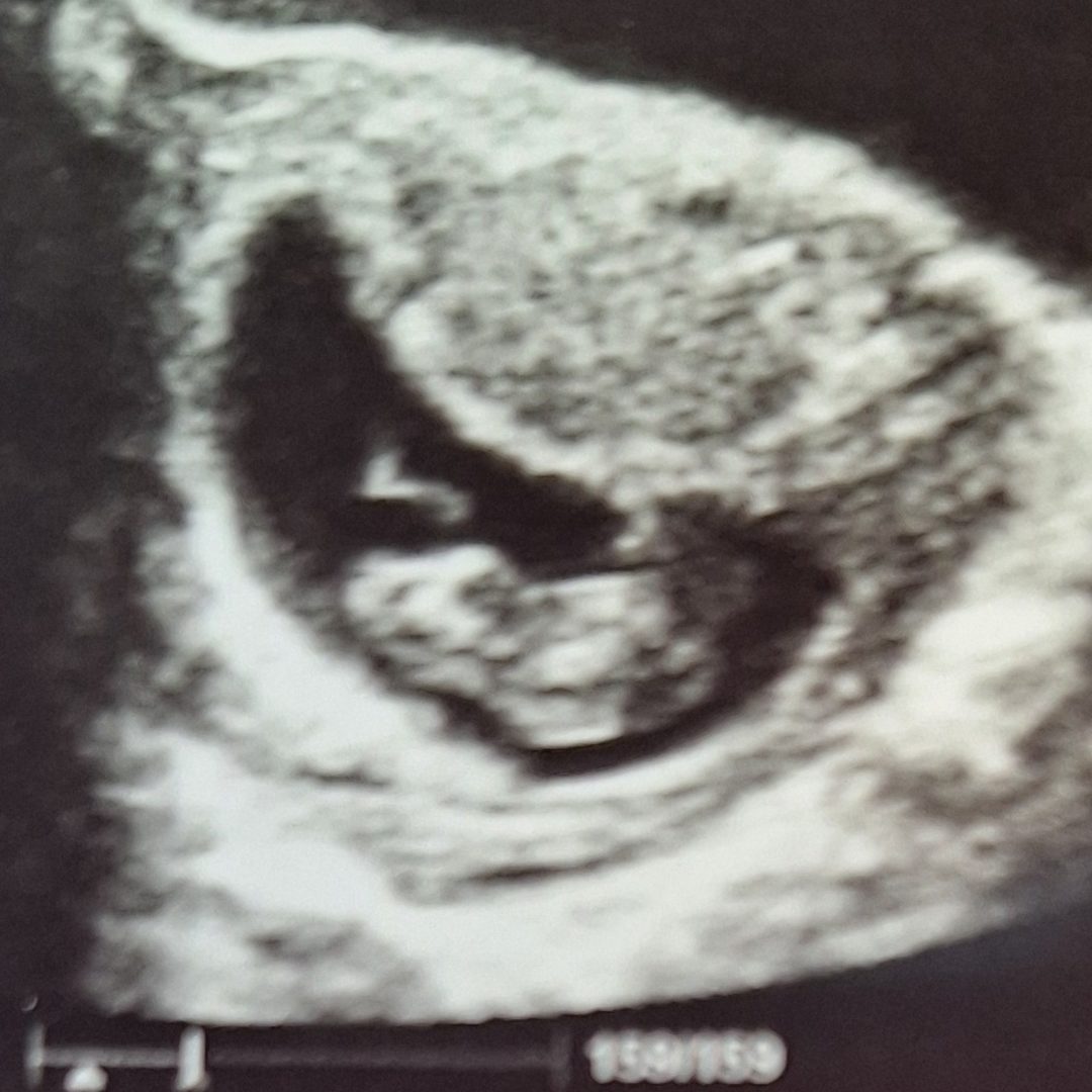 Photo shared by Amelia for their Babylist baby registry.
