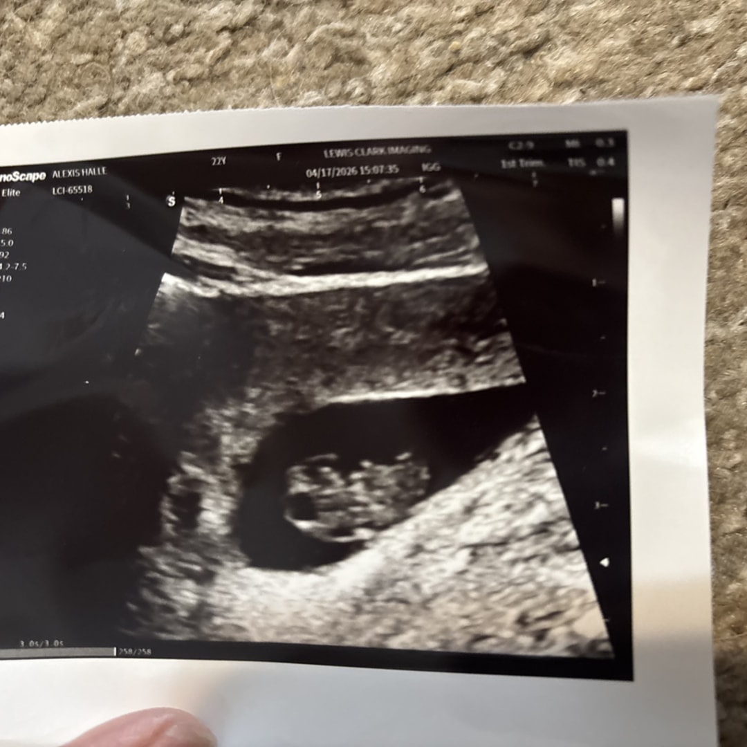 Photo shared by Alexis for their Babylist baby registry.