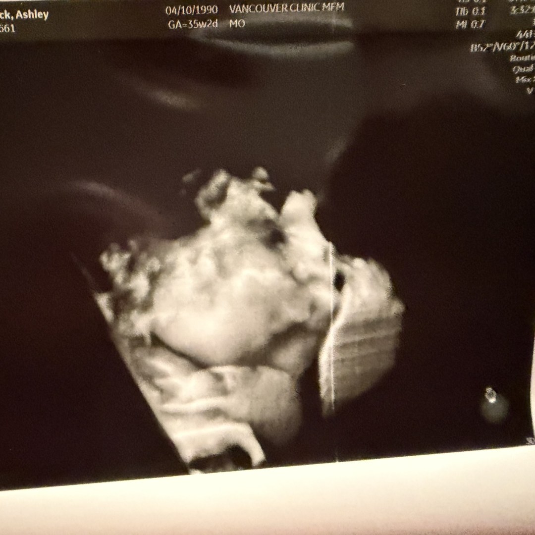 Photo shared by Ashley for their Babylist baby registry.
