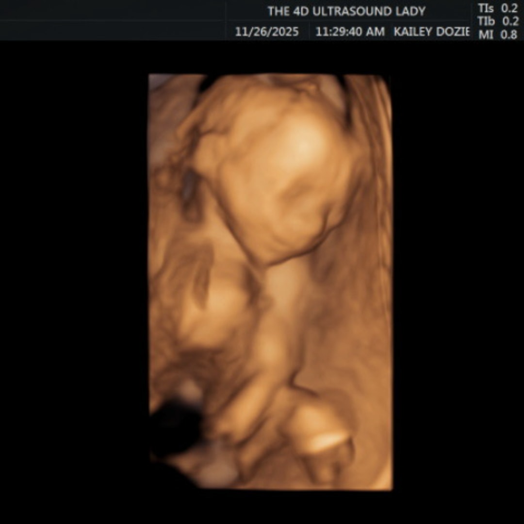 Photo shared by Champaine for their Babylist baby registry.