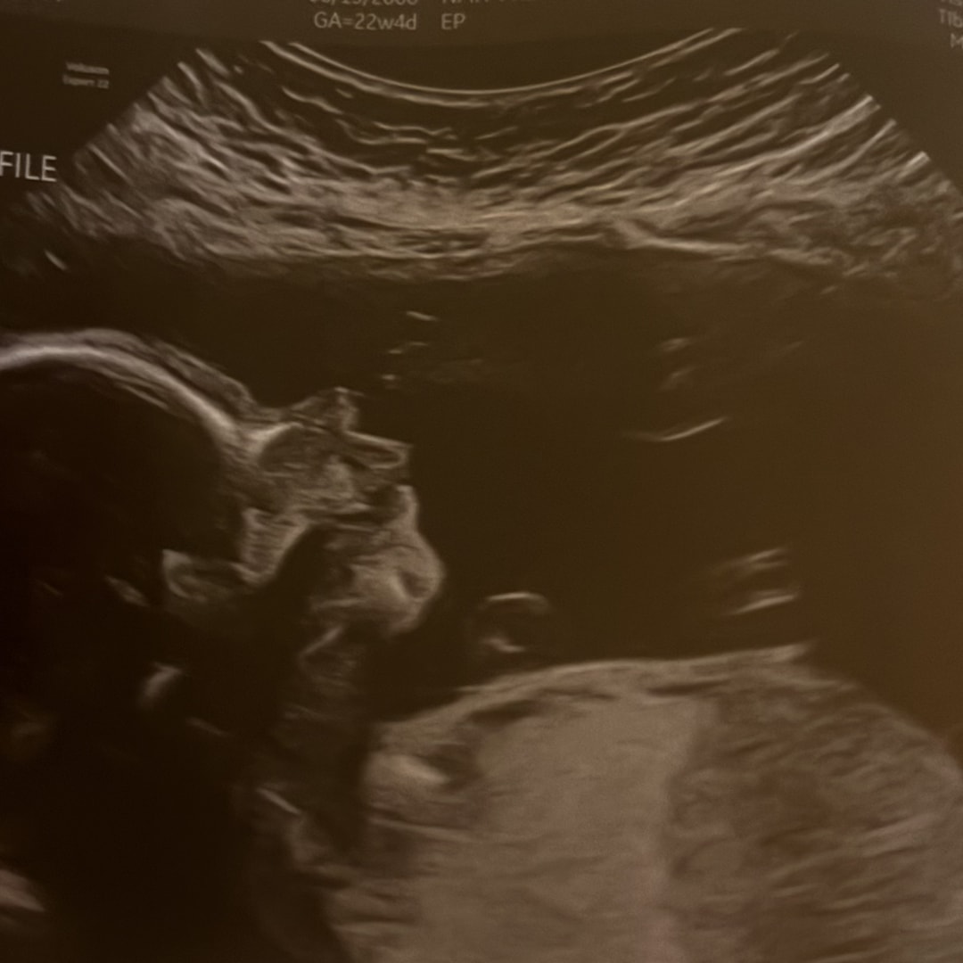 Photo shared by Andrea for their Babylist baby registry.