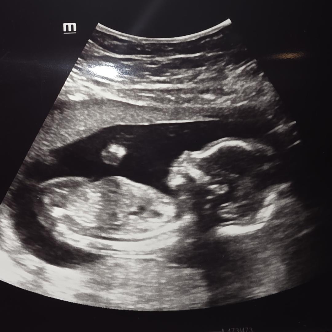 Photo shared by Lidia for their Babylist baby registry.