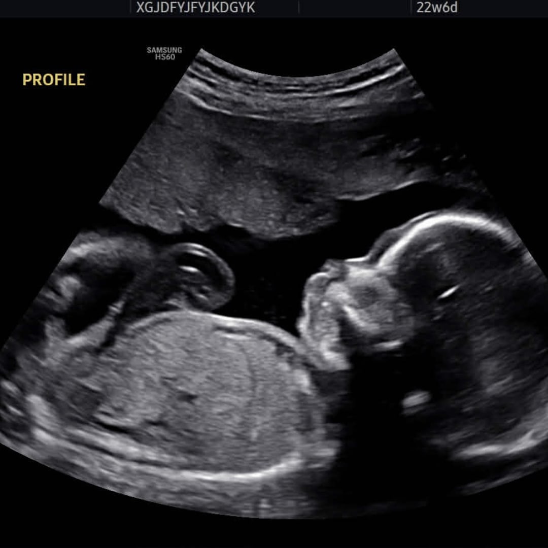 Photo shared by Adisyn for their Babylist baby registry.