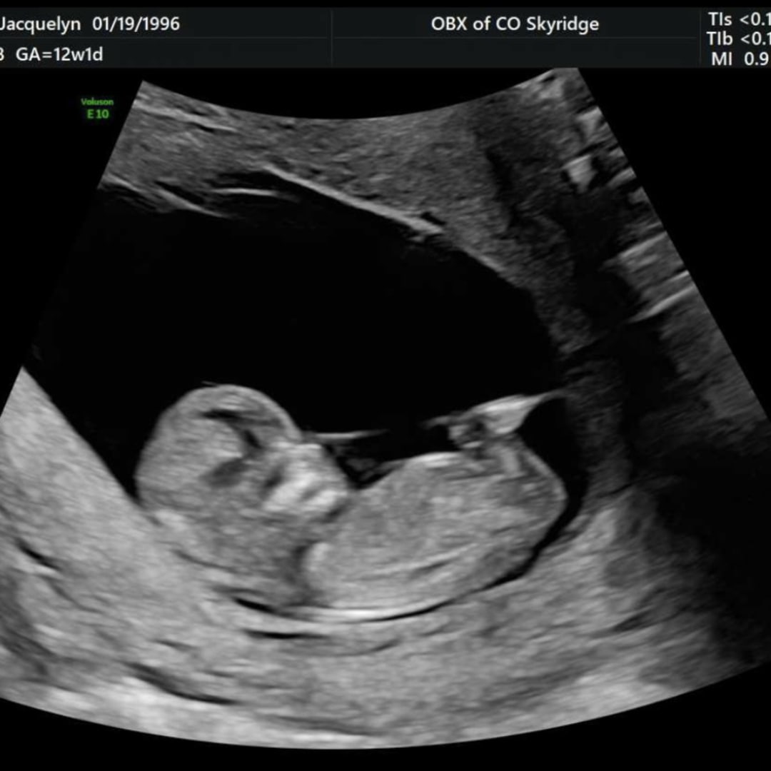 Photo shared by Jackie for their Babylist baby registry.