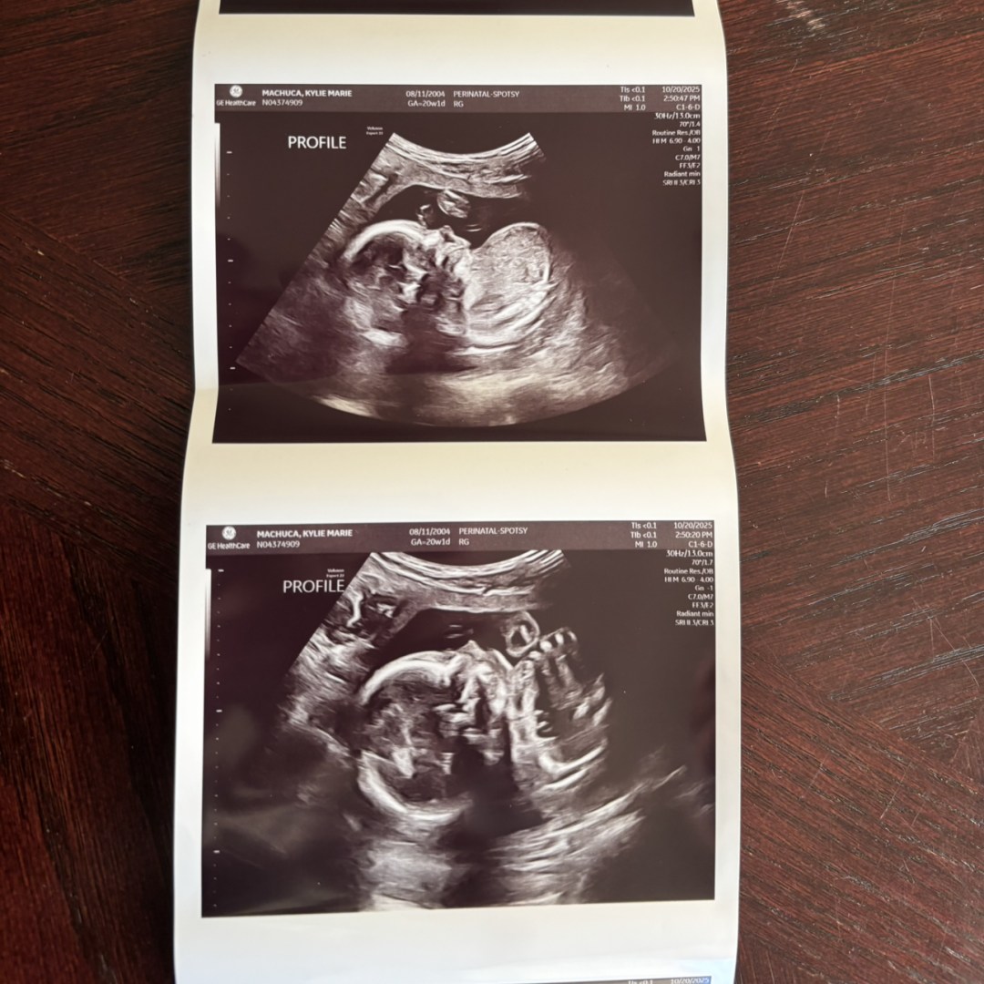 Photo shared by Kylie for their Babylist baby registry.